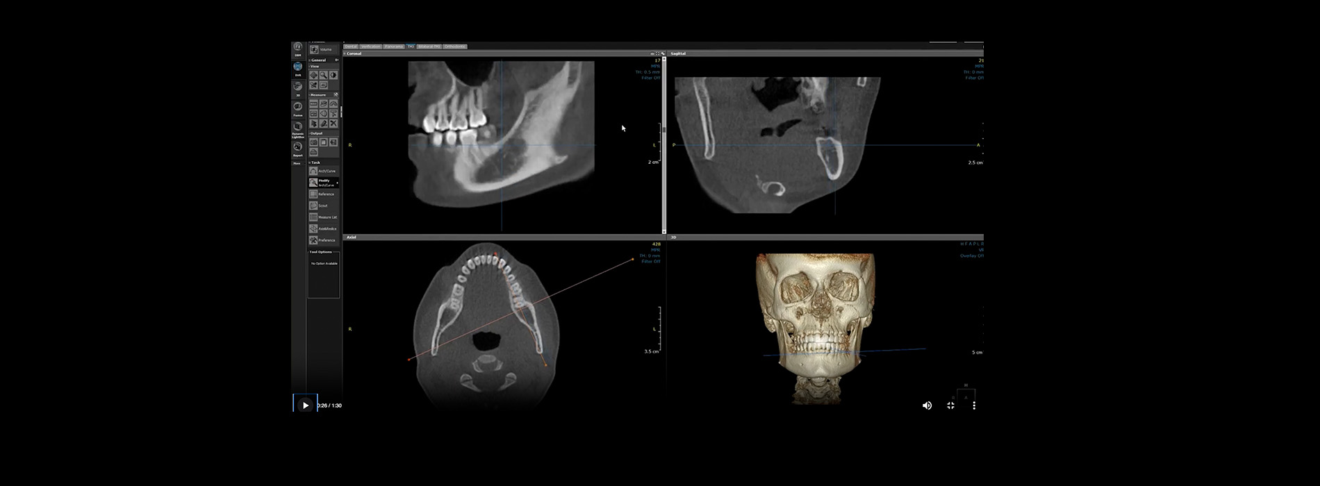 Restoration Dental | Oral Exams, Pediatric Dentistry and Periodontal Treatment