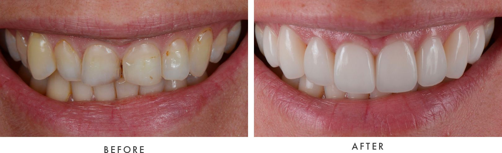 Restoration Dental | Digital Impressions, Periodontal Treatment and Dentures